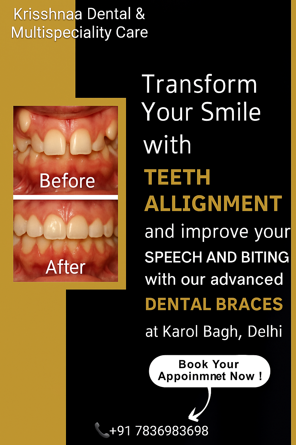Transform Your Smile with Dental Braces at Krisshnaa Dental  And Multispeciality Care Karol Bagh Delhi